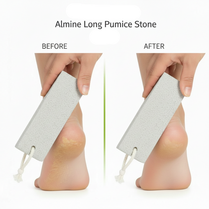 Comparison of a foot before and after using a long pumice stone to remove dry, rough skin, demonstrating smoother heel results with Annie International professional beauty tools.