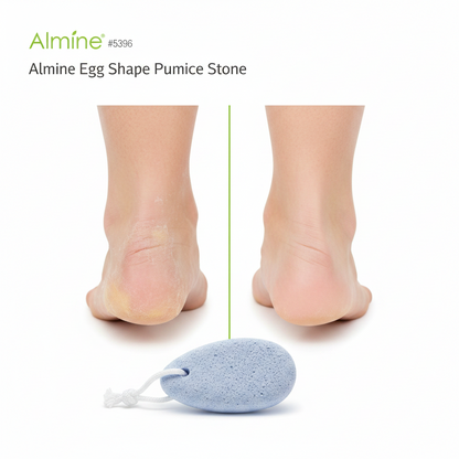Side-by-side comparison of a heel before and after using a white egg-shaped pumice stone cleaning rough dry skin and showing smooth soft skin after treatment.